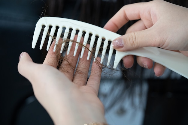 Problema de caída del cabello