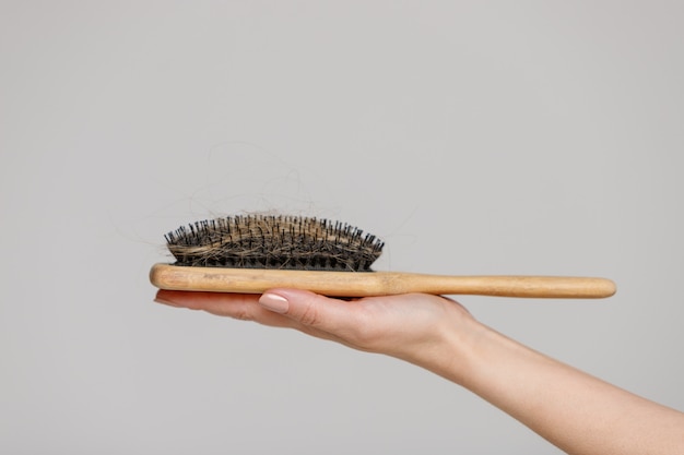 Foto problema de pérdida de cabello. cerca de la mano de mujer con cepillo de peine con cabello perdido, vista lateral