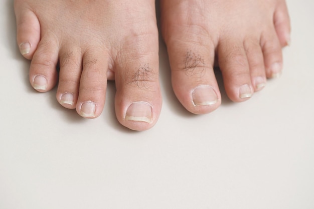El problema de las uñas largas y sucias con gérmenes bacterianos
