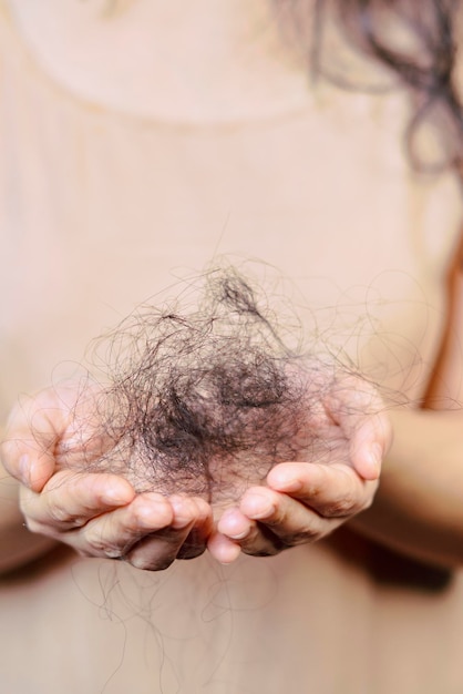 Problemas de pérdida de cabello femenino