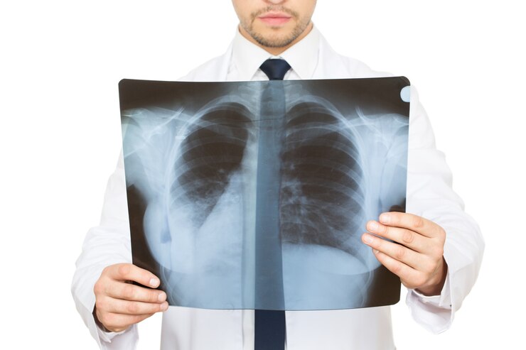 Foto problemas respiratórios? foto de estúdio recortada de um médico examinando uma radiografia de pulmões e costelas de seu paciente