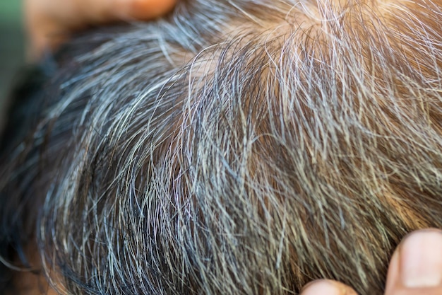 Probleme mit grauen Haaren bei älteren Männern Alter asiatischer Senior mit grauen Haaren, weißen Haaren oder Haarausfall