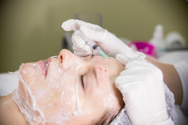 Procedimento cosmético de mesoterapia fazendo injeções na testa
