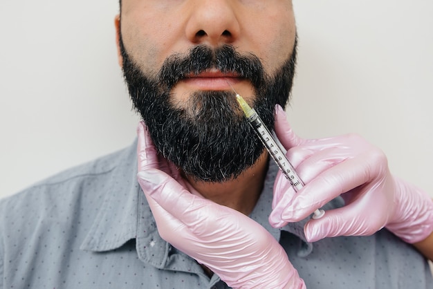 Procedimento cosmético para aumento dos lábios e remoção de rugas em um homem barbudo. cosmetologia.