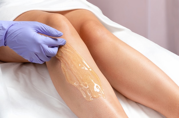 Procedimento de aplicação de açúcar nos pés em um salão de beleza. Um mestre com luvas aplica pasta de açúcar na perna de uma mulher para depilação.