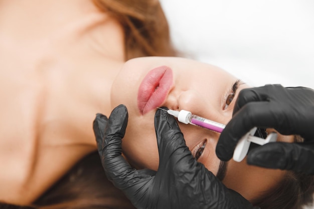 Procedimento de aumento de lábios de lábios femininos Uma seringa perto da boca de uma mulher injeções para aumentar a forma dos lábios