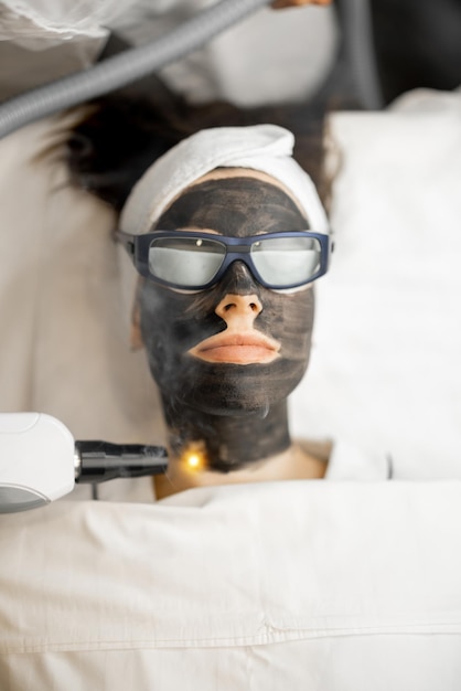 Procedimento de beleza de peeling de carbono a laser no rosto da mulher