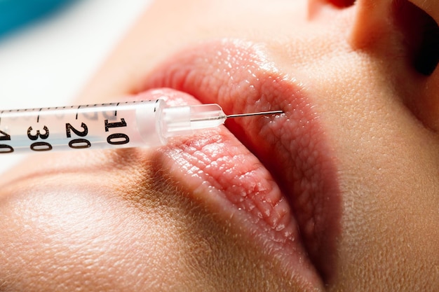 Foto procedimento de correção de forma labial em um salão de cosmetologia o especialista faz uma injeção nos lábios