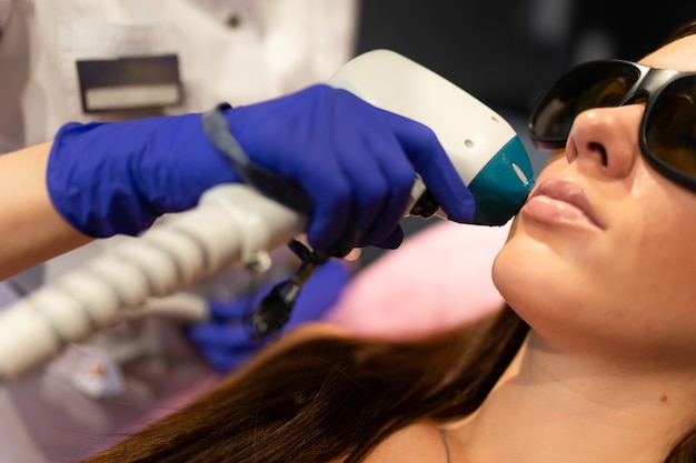 Procedimento de depilação a laser facial