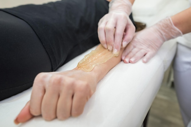 Procedimento de depilação com pasta de açúcar shugaring Cosmetologista aplica pasta de açúcar na mão de uma jovem Depilação de mãos femininas em um salão de beleza