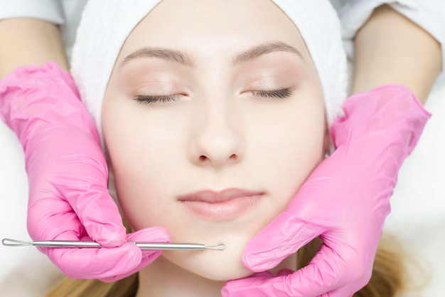 Foto procedimento para limpar a pele com ferramenta de aço de cravos e acne limpeza profunda do rosto feminino com removedor de cravo no salão de beleza cosmetologista recebendo terapia de limpeza