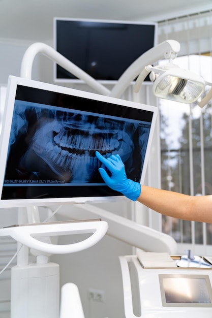 Foto profissional de dentes examinando tratamento de radiografia de odontologia de raio x