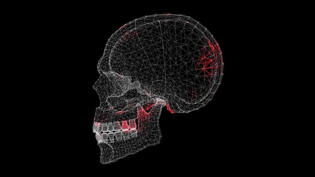 Propagación del virus a través del cráneo humano 3D sobre fondo negro Demostración visual del virus en el cuerpo Ciencia Concepto médico Animación 3D