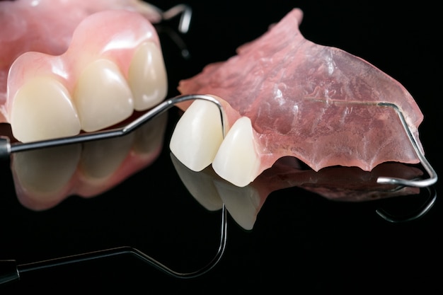 Foto prótese temporária e ferramentas dentárias.