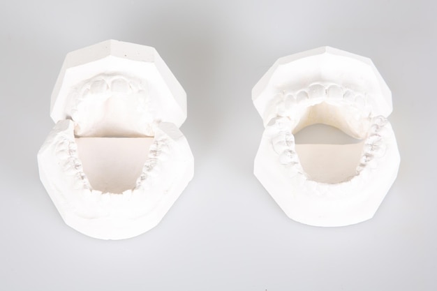 Próteses dentárias implantes dentários gesso impressão dentes de gesso branco em laboratório dentário em fundo cinza