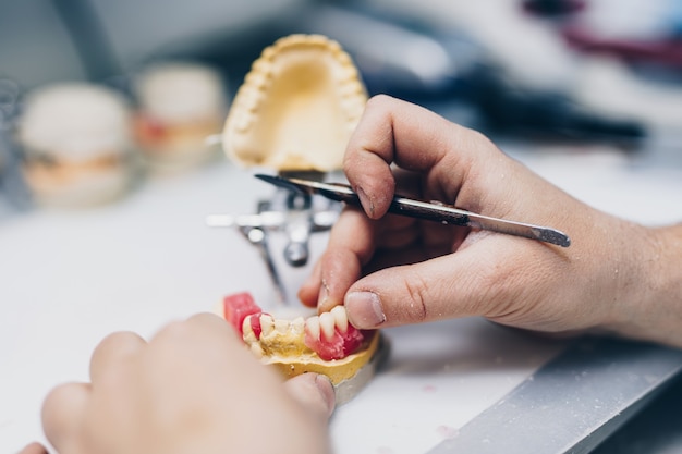 Prótesis dentales, trabajos de prótesis. Cerca de las manos del protésico mientras trabaja en la dentadura. Enfoque selectivo.