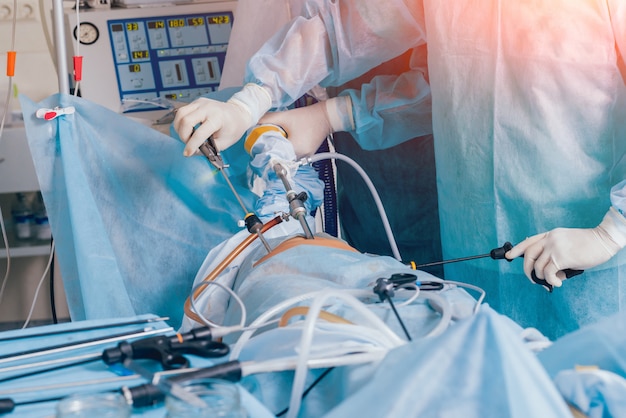 Prozess der gynäkologischen Chirurgie Operation mit laparoskopischen Geräten. Gruppe von Chirurgen im Operationssaal mit chirurgischen Geräten