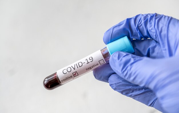 Prueba de coronavirus