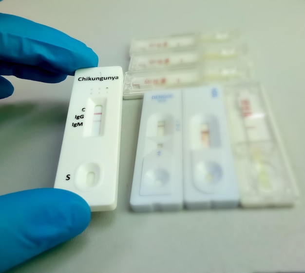 Prueba de detección rápida de Chikungunya IgG e IgM que muestra un resultado positivo de IgG