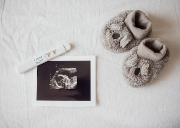 Foto prueba de embarazo zapatitos y foto de rayos x