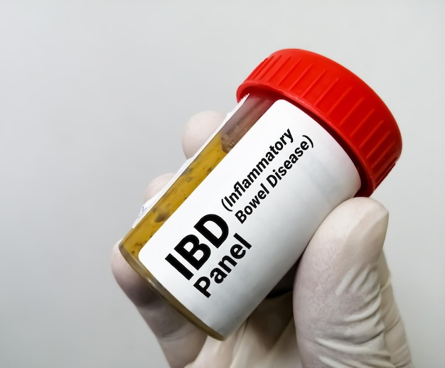 Foto prueba de enfermedad inflamatoria intestinal (ibd)
