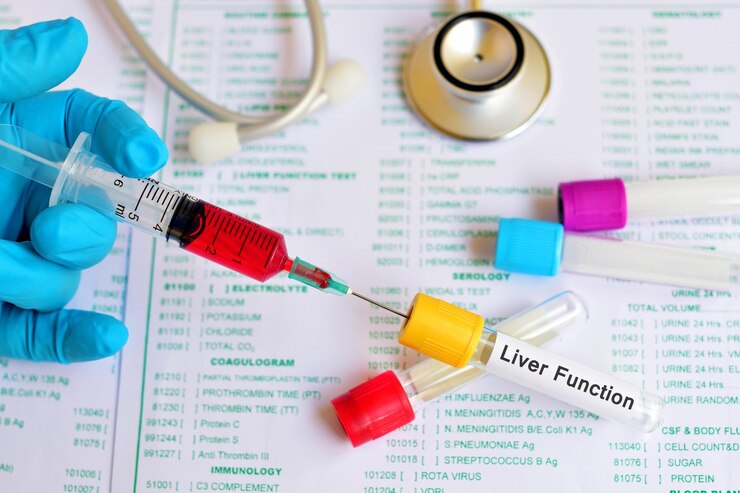 Foto prueba de sangre para la función hepática