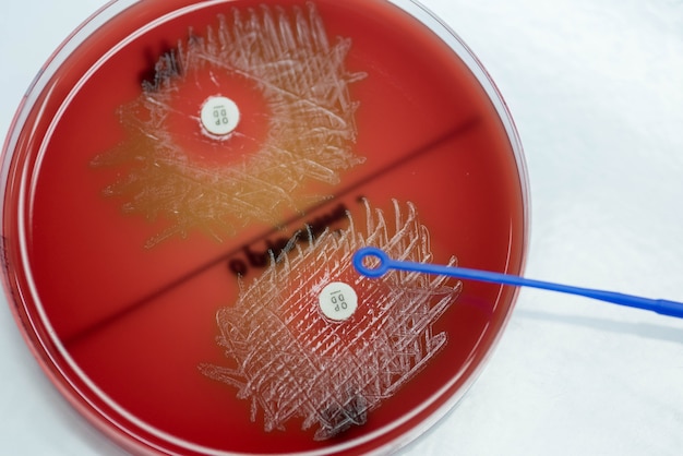 Foto la prueba de subsensibilidad de optoquina en la placa de agar con sangre contiene streptococcus pneumoniae.