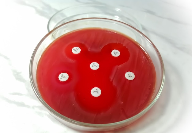 Prueba de susceptibilidad antimicrobiana en placa de Petri. Resistencia a los antibióticos de las bacterias.