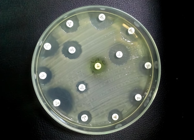 Foto prueba de susceptibilidad antimicrobiana en placa de petri