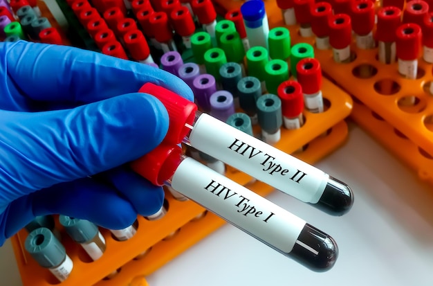 Pruebas de anticuerpos contra el VIH tipo 1 y el VIH tipo 2 para el diagnóstico de la infección por el VIH