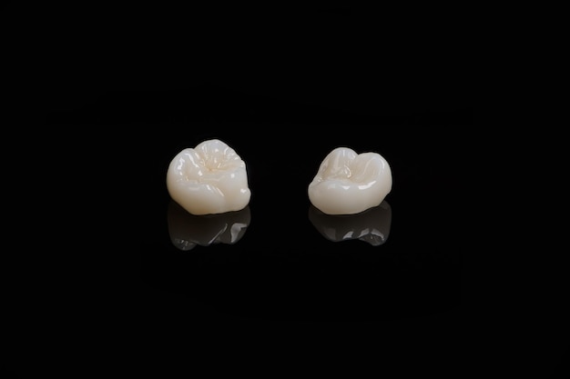 Qualifizierte anatomische Keramik- und Zirkonia-Kronen menschlicher Zähne schließen Makro isoliert auf Schwarz