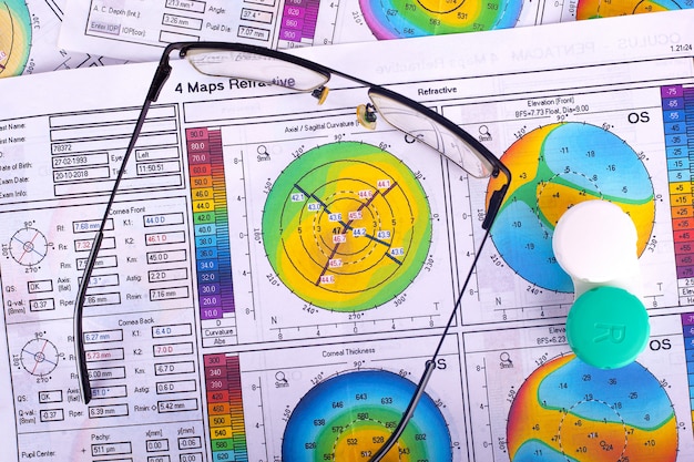 Foto queratocono 2-3 etapas, topografía corneal y lentes de visión, enfermedad de visión periférica, vista superior.