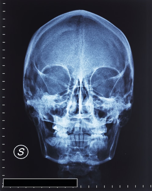 Foto radiografía del cráneo