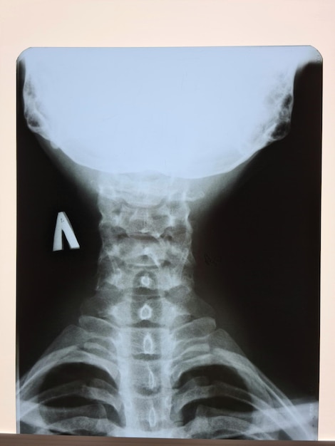 Foto radiografía de cuello en laboratorio de clínica