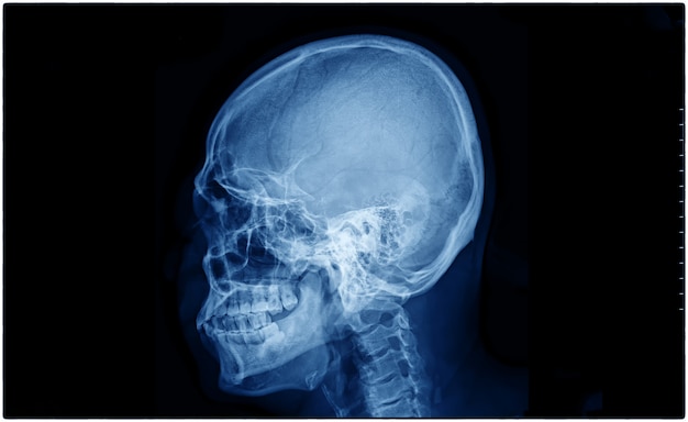 Radiografia do crânio de um paciente