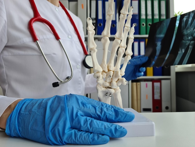 Foto radiografía de mano en manos del médico anatomía de manos