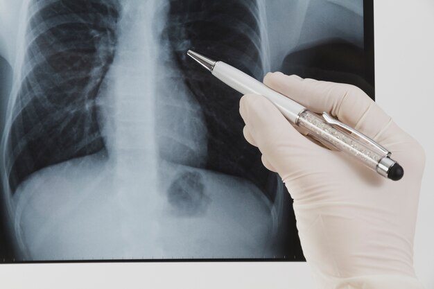 Radiographie mit Stift