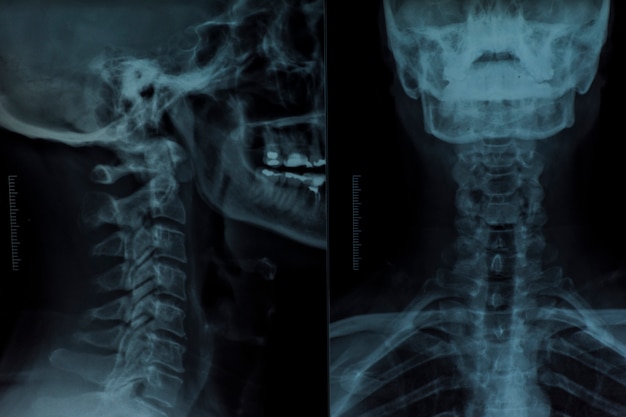 Página 53  Mandibula Raio X Imagens – Download Grátis no Freepik