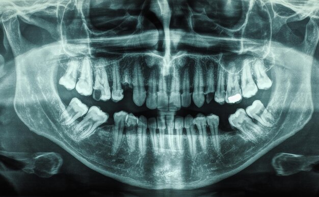 Foto raio x dos dentes humanos