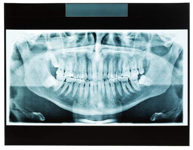 Foto raio-x médico na mesa