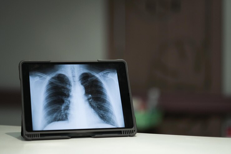 Foto raio-x no ecrã de um tablet digital no hospital