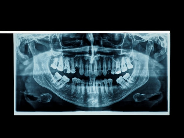 Foto raio x panorâmico de ossos de dentes humanos