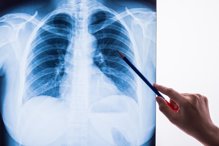 Foto raio x preto e branco imagem de um peito humano para um diagnóstico médico