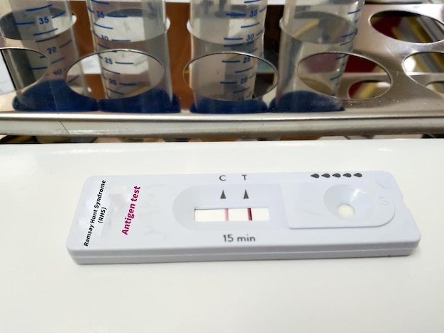 Ramsay-Hunt-Syndrom (RHS)-Test mit Schnelltestkassette im medizinischen Labor. Ergebnis positiv