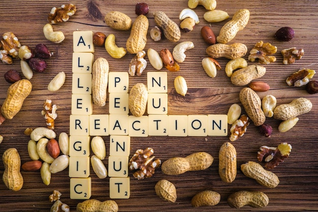 Foto reacción alérgica cacahuetes concepto de estilo de crucigrama entre varias mezclas selección de nueces como cacahuetes