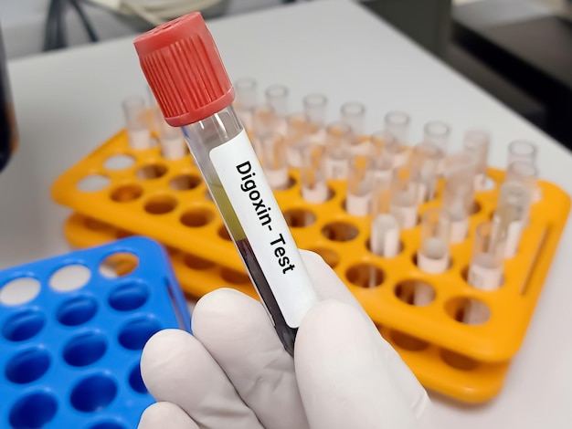 Reagenzglas mit Blutprobe für Digoxin-Level-Test, Medikament für Herzerkrankungen.