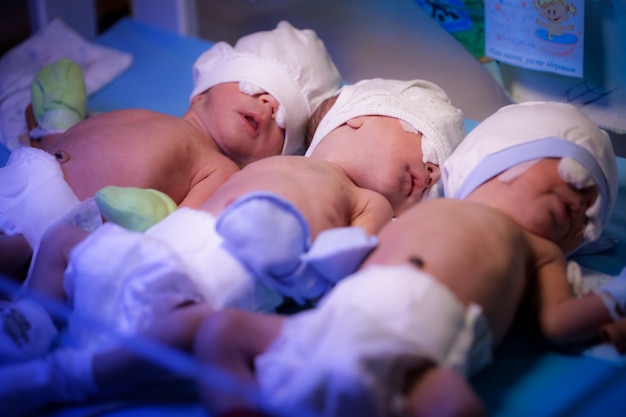 Foto recém-nascidos trigêmeos bebê estão sob o dispositivo com radiação ultravioleta na maternidade