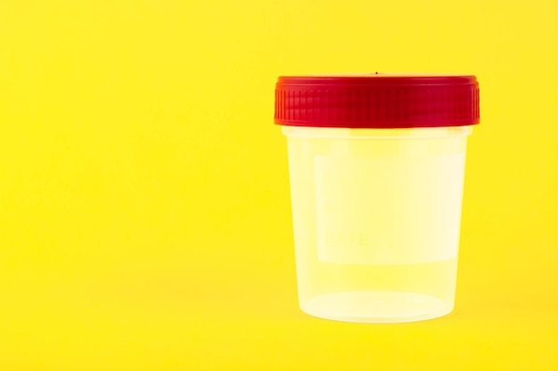 Foto recipiente vazio, plástico transparente, branco com uma tampa vermelha para coletar urina em um amarelo