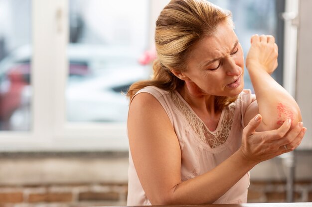 Reife blonde Frau mit starker Glutenallergie, die Ausschlag am Ellbogen bemerkt