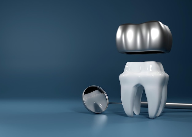 Representación 3d de cirugía de implantes dentales